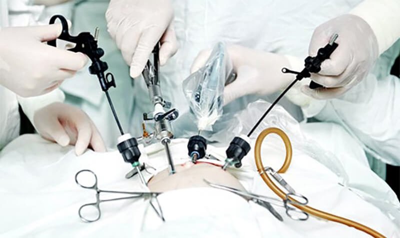 Minimally Invasive Surgery in Ahmedabad