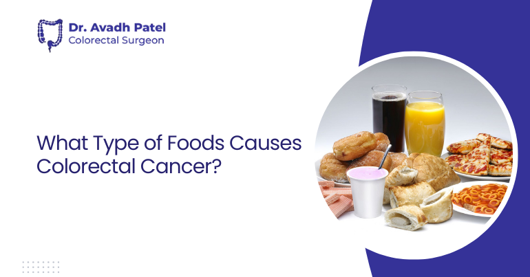 What Type of Foods Cause Colorectal Cancer?