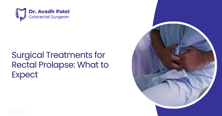 Surgical Treatments for Rectal Prolapse: What to Expect