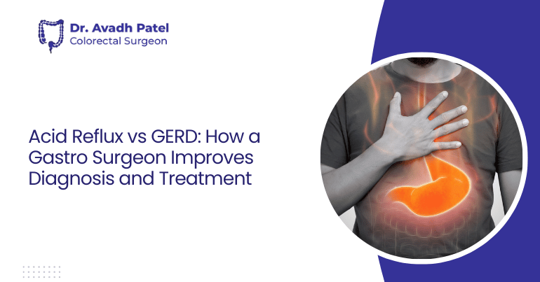 Acid Reflux vs GERD: How a Gastro Surgeon Improves Diagnosis and Treatment