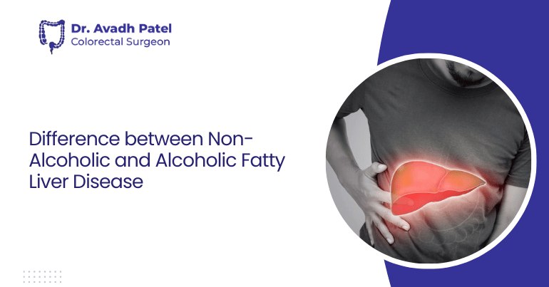 Difference Between Non-Alcoholic and Alcoholic Fatty Liver Disease