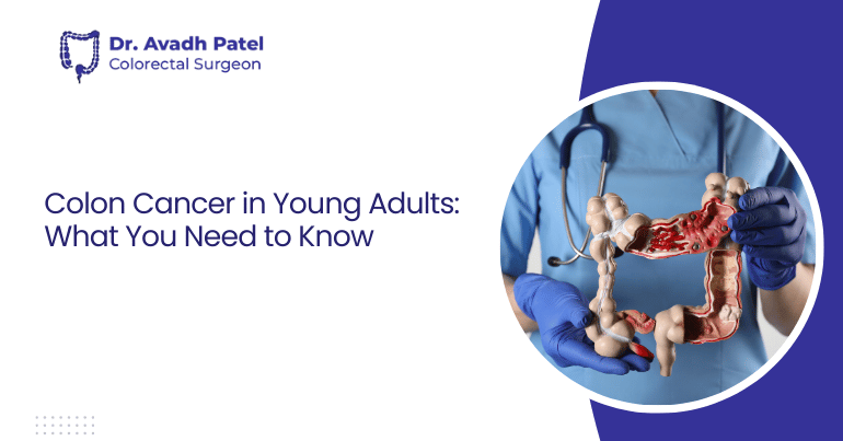 Colon Cancer in Young Adults: What You Need to Know