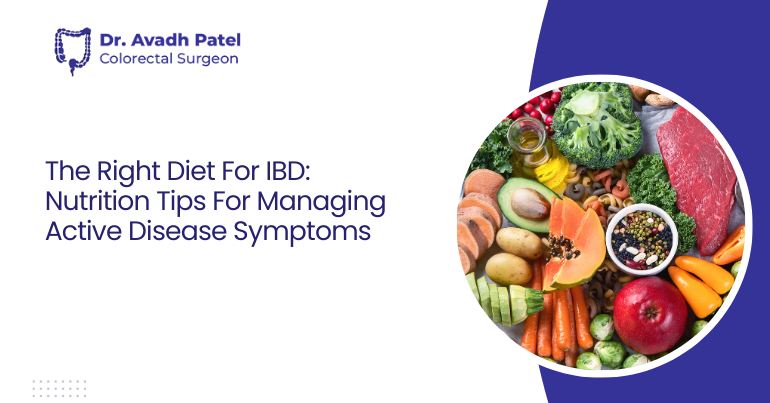 The Right Diet For IBD: Nutrition Tips For Managing Active Disease Symptoms