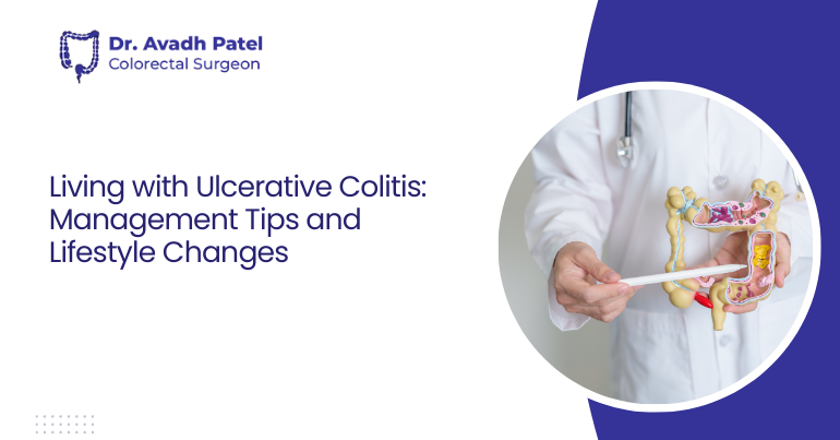 Living with Ulcerative Colitis: Management Tips and Lifestyle Changes
