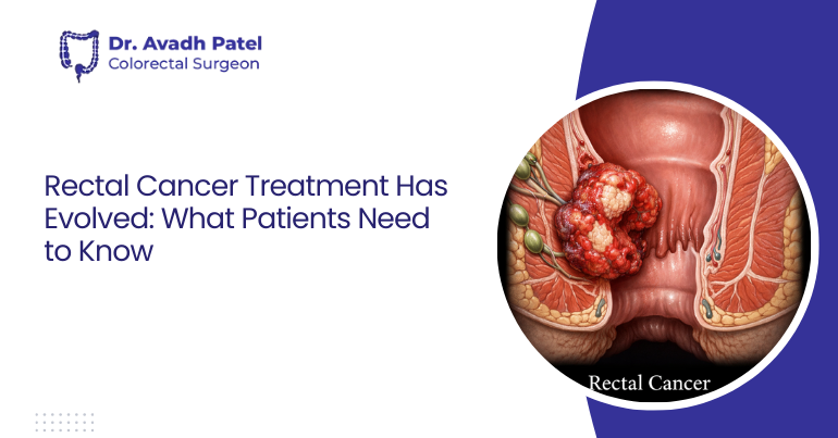 Rectal Cancer Treatment Has Evolved: What Patients Need to Know