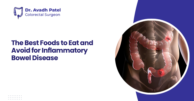 The Best Foods to Eat and Avoid for Inflammatory Bowel Disease