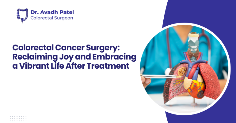 Colorectal Cancer Surgery: Reclaiming Joy and Embracing a Vibrant Life After Treatment