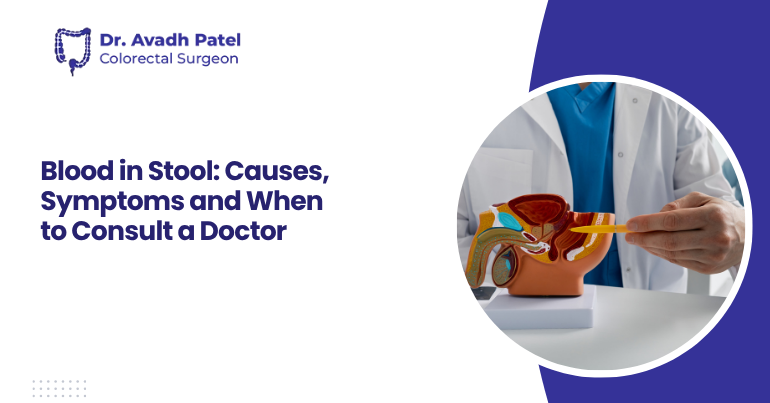 Blood in Stool: Causes, Symptoms and When to Consult a Doctor