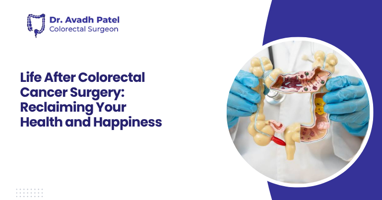 Life After Colorectal Cancer Surgery: Reclaiming Your Health and Happiness 