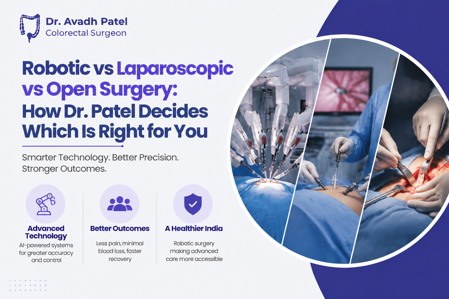 Robotic vs laparoscopic vs open surgery for colon conditions